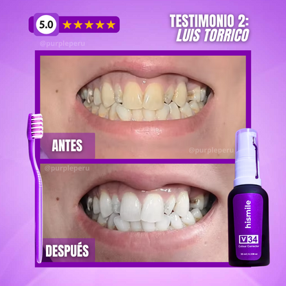 BLANQUEADOR DENTAL SMILEKIT®