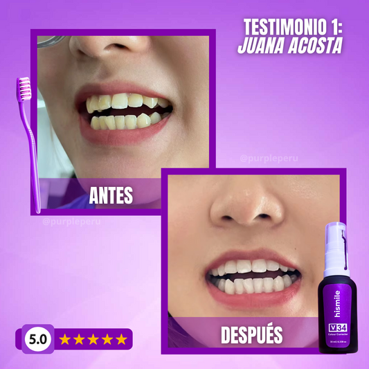 BLANQUEADOR DENTAL SMILEKIT®