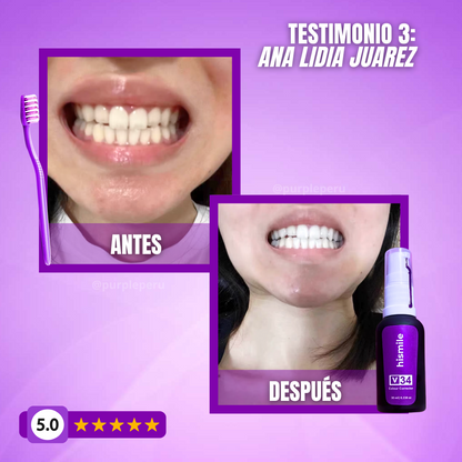BLANQUEADOR DENTAL SMILEKIT®