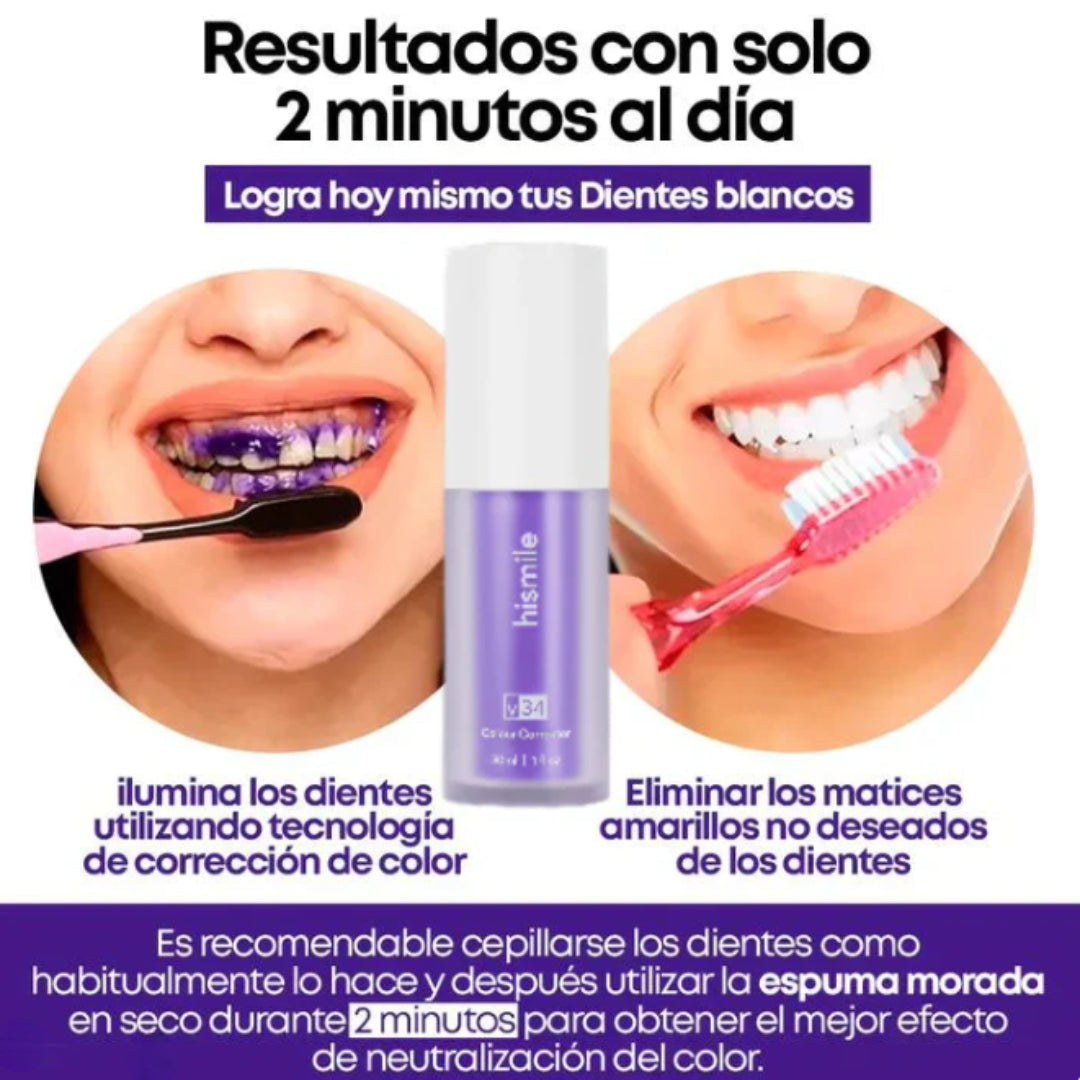 BLANQUEADOR DENTAL SMILEKIT®
