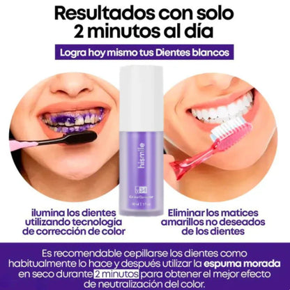 BLANQUEADOR DENTAL SMILEKIT®